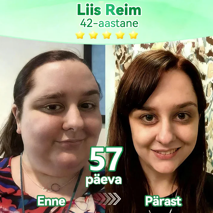 【𝐕𝐢𝐢𝐦𝐚𝐧𝐞 𝐩𝐚̈𝐞𝐯𝐚 𝐤𝐚𝐦𝐩𝐚𝐚𝐧𝐢𝐚 −90%】 💚💚𝑭𝒍𝒐𝒓𝒊𝒔𝒎𝒂® 𝑴𝒐𝒓𝒊𝒏𝒈𝒂 𝑿 𝑩𝒆𝒓𝒃𝒆𝒓𝒊𝒊𝒏 10-𝑰𝒏-1 𝑨𝒓𝒆𝒏𝒆𝒏𝒖𝒅 𝑵𝒂𝘯𝘰 𝑴𝒊𝒌𝒓𝒐𝒏õ𝒆𝒍𝒂𝒅 𝑷𝒍𝒂𝒂𝒔𝒕𝒆𝒓